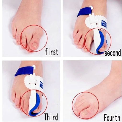 Orthopedic Thumb Corrector