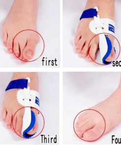 Orthopedic Thumb Corrector